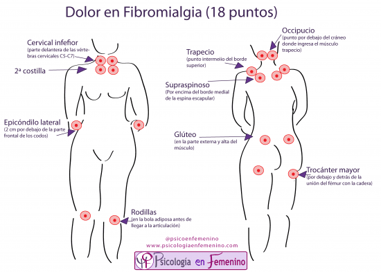 el dolor en la fibromialgia